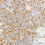 PYCARD Antibody in Immunohistochemistry (Paraffin) (IHC (P))