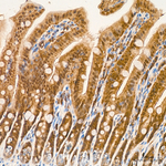 PYCARD Antibody in Immunohistochemistry (Paraffin) (IHC (P))