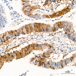 Thymidylate Synthase Antibody in Immunohistochemistry (Paraffin) (IHC (P))