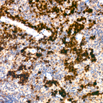 Thymidylate Synthase Antibody in Immunohistochemistry (Paraffin) (IHC (P))