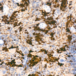 Thymidylate Synthase Antibody in Immunohistochemistry (Paraffin) (IHC (P))