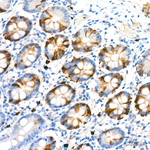 Thymidylate Synthase Antibody in Immunohistochemistry (Paraffin) (IHC (P))