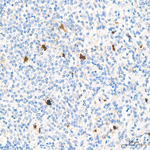 Thymidylate Synthase Antibody in Immunohistochemistry (Paraffin) (IHC (P))