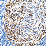 Thymidylate Synthase Antibody in Immunohistochemistry (Paraffin) (IHC (P))