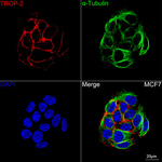 TROP2 Recombinant Rabbit Monoclonal Antibody (7J6L5)
