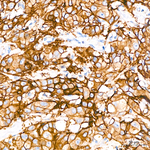 TROP2 Antibody in Immunohistochemistry (Paraffin) (IHC (P))