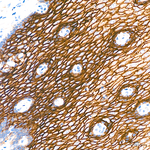 TROP2 Antibody in Immunohistochemistry (Paraffin) (IHC (P))