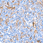 TROP2 Antibody in Immunohistochemistry (Paraffin) (IHC (P))