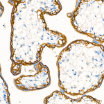 TROP2 Antibody in Immunohistochemistry (Paraffin) (IHC (P))