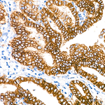 TROP2 Antibody in Immunohistochemistry (Paraffin) (IHC (P))