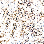 HEXIM1 Antibody in Immunohistochemistry (Paraffin) (IHC (P))