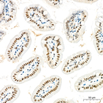 HEXIM1 Antibody in Immunohistochemistry (Paraffin) (IHC (P))