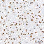 HEXIM1 Antibody in Immunohistochemistry (Paraffin) (IHC (P))