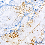 CD177 Recombinant Rabbit Monoclonal Antibody (7G1K9)