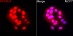PP1 alpha Recombinant Rabbit Monoclonal Antibody (5I9Y7)