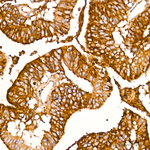 IFITM3 Recombinant Rabbit Monoclonal Antibody (9W5B3)