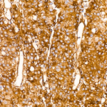 IFITM3 Antibody in Immunohistochemistry (Paraffin) (IHC (P))