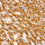 IFITM3 Antibody in Immunohistochemistry (Paraffin) (IHC (P))