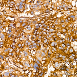 IFITM3 Antibody in Immunohistochemistry (Paraffin) (IHC (P))