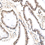 FosB Recombinant Rabbit Monoclonal Antibody (0Z6D1)