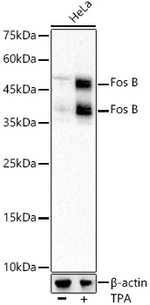 FosB Antibody in Western Blot (WB)
