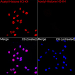 H3K4ac Antibody in Immunocytochemistry (ICC/IF)
