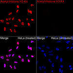 H3K4ac Antibody in Immunocytochemistry (ICC/IF)