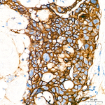 Claudin 3 Antibody in Immunohistochemistry (Paraffin) (IHC (P))