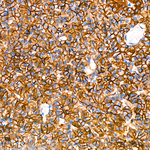 Claudin 3 Antibody in Immunohistochemistry (Paraffin) (IHC (P))