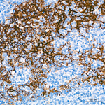 Claudin 3 Antibody in Immunohistochemistry (Paraffin) (IHC (P))