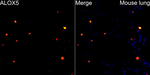 ALOX5 Recombinant Rabbit Monoclonal Antibody (8Q5H4)