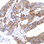 ATPIF1 Antibody in Immunohistochemistry (Paraffin) (IHC (P))