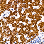 ATPIF1 Antibody in Immunohistochemistry (Paraffin) (IHC (P))