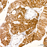 TOMM40 Antibody in Immunohistochemistry (Paraffin) (IHC (P))