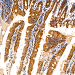 TOMM40 Antibody in Immunohistochemistry (Paraffin) (IHC (P))
