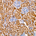 TOMM40 Antibody in Immunohistochemistry (Paraffin) (IHC (P))