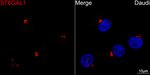 CD75 Recombinant Rabbit Monoclonal Antibody (10D6U4)