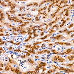 CD75 Antibody in Immunohistochemistry (Paraffin) (IHC (P))