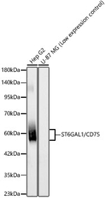 CD75 Antibody in Western Blot (WB)