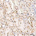 NR2F2 Antibody in Immunohistochemistry (Paraffin) (IHC (P))