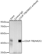 NR2F2 Antibody in Immunoprecipitation (IP)