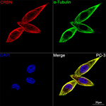CRBN Antibody in Immunocytochemistry (ICC/IF)