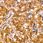 CRBN Antibody in Immunohistochemistry (Paraffin) (IHC (P))