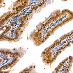 CRBN Antibody in Immunohistochemistry (Paraffin) (IHC (P))