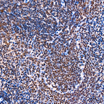 CRBN Antibody in Immunohistochemistry (Paraffin) (IHC (P))