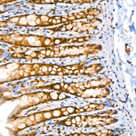 CRBN Antibody in Immunohistochemistry (Paraffin) (IHC (P))