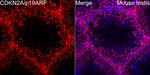 p19ARF Antibody in Immunohistochemistry (Paraffin) (IHC (P))