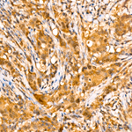 4EBP1 Antibody in Immunohistochemistry (Paraffin) (IHC (P))