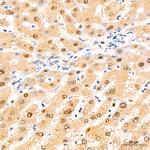 4EBP1 Antibody in Immunohistochemistry (Paraffin) (IHC (P))