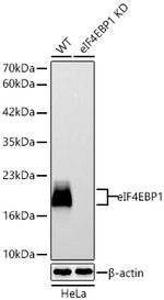 4EBP1 Antibody in Western Blot (WB)